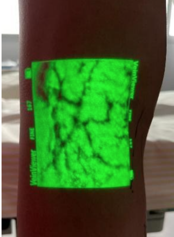 Realidade aumentada Ultrassom com doppler