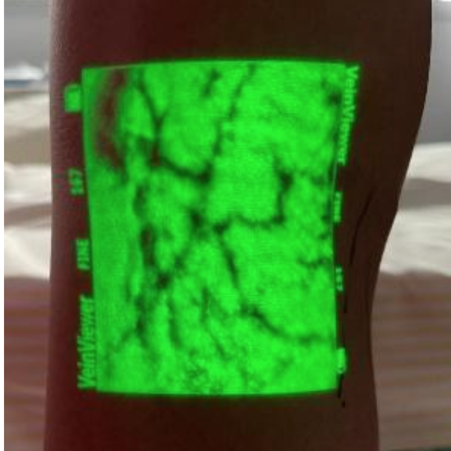 Ultrassom com doppler